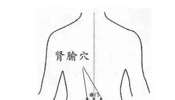 活动|这四类人肾脏很容易坏掉，警惕三种表现，做好三件事，肾会变好！