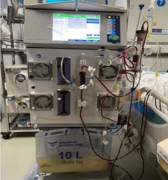 山药|女子一顿吃了3斤牛肉+海参炖鸡，结果进了ICU！