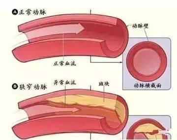 红细胞|肾功能下降，血压升高，血脂升高，肾脏疾病，应当提防
