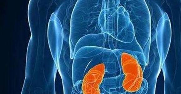 肾脏|肾结石来临时，身体会出现这些信号，别对此不屑一顾！