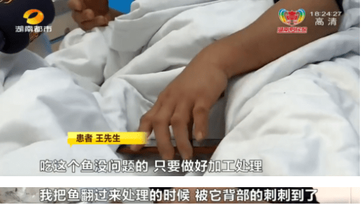 長沙|男子被魚刺扎一下緊急送醫！醫生：?這種魚刺毒性極強！6根可致死