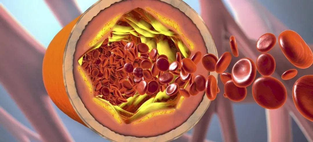 水平|4成血脂异常!!国人健康何以为继??