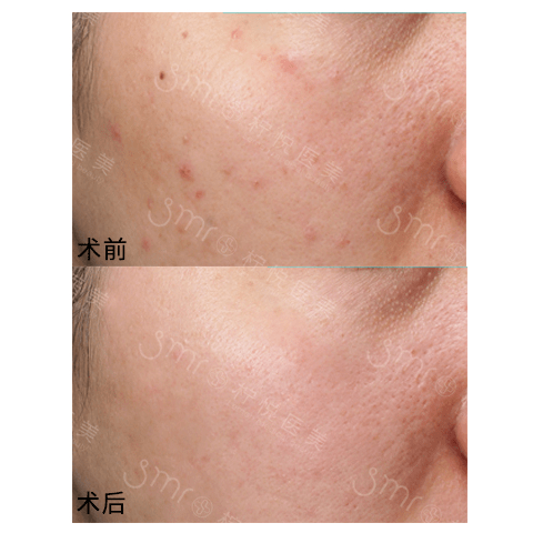 症状不做轻医美很惨,做了轻医美更惨?