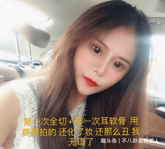 因为00后网红整容成瘾，13岁开整花费百万，整成惊悚脸想选秀出道