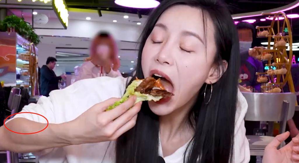 原创大胃王小贝越吃越瘦胳膊肿胀疑似营养不良网友都瘦脱相了