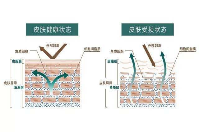 品牌换季护肤大杀器，敏感肌必备的精华油