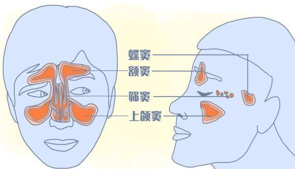 鼻塞,頭痛,流鼻涕,警惕