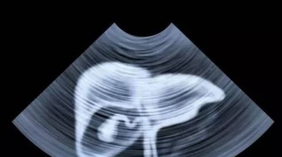 肝脏|肝功差的人，身体一般有5个表现，若没有，则肝脏还算健康