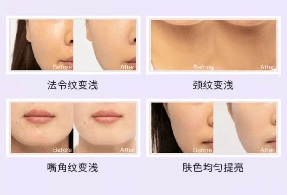 家族a醛才是抗老界扛把子？维a家族不翻车怎么选？