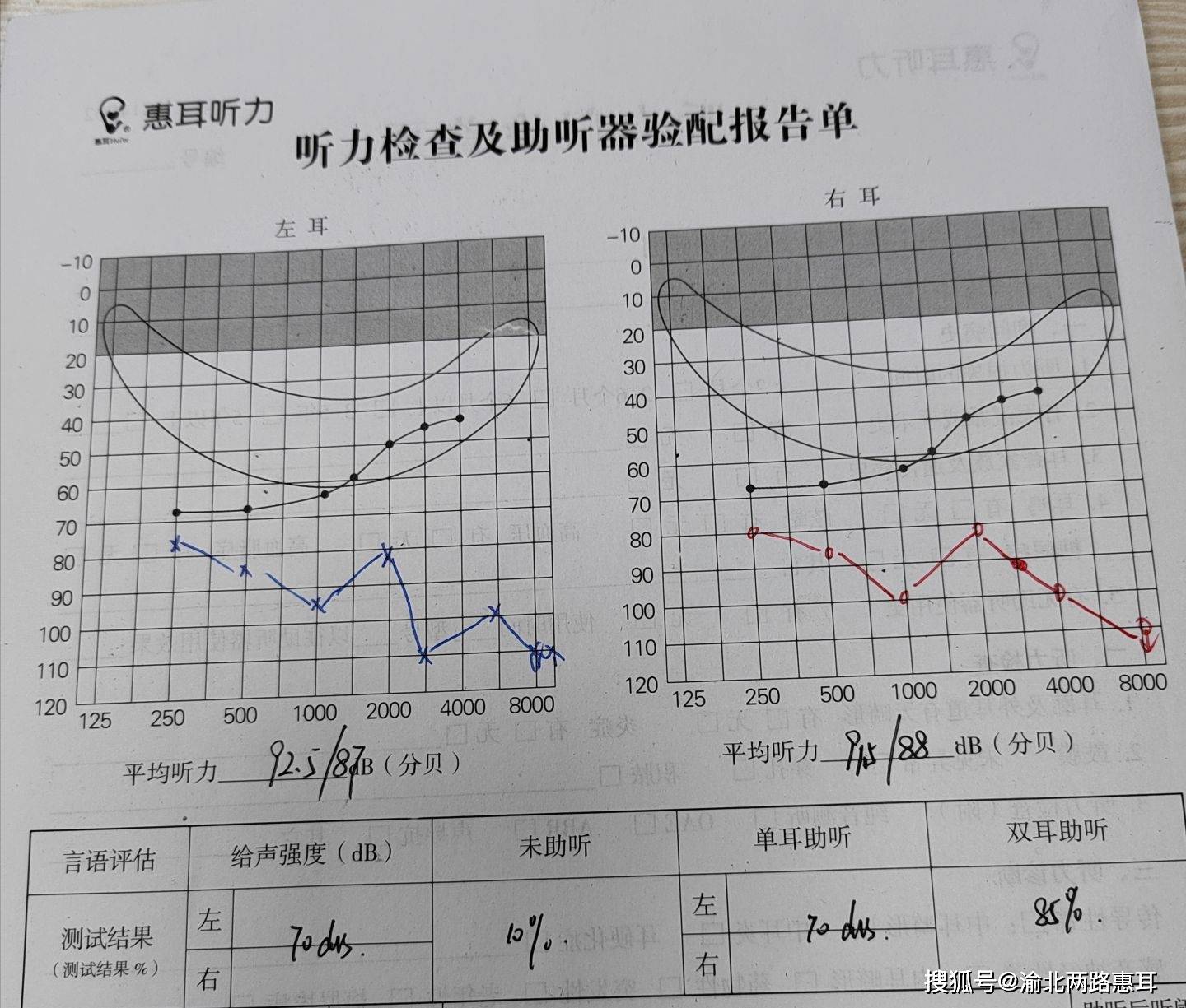 聆听健康的声音——听力检测的重要性与发展趋势