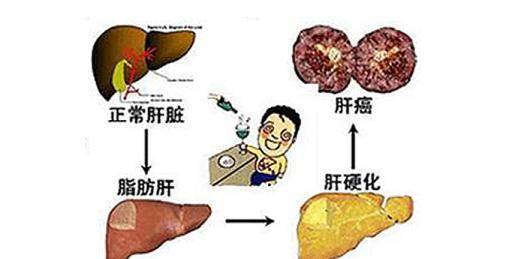 因为|肝脏最怕以下3件事，现在改过，还来得及