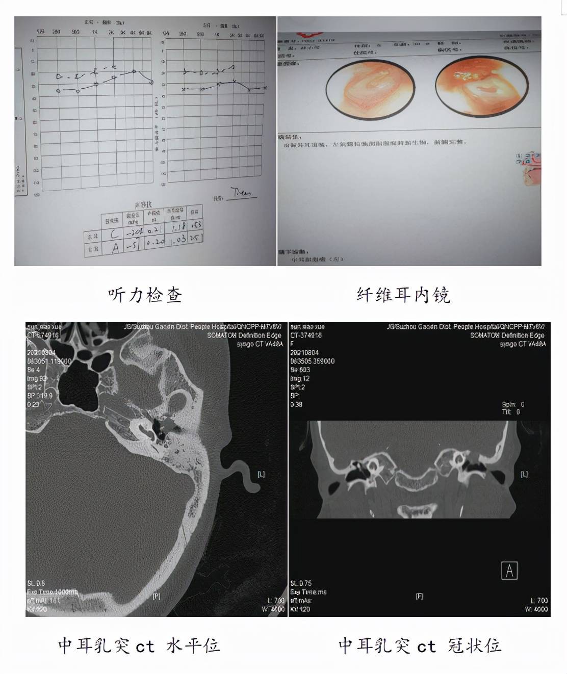 耳朵检查报告图片图片