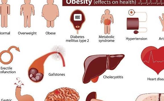 饮食|运动加饮食就能控制血糖？医生辟谣，关于糖尿病运动和饮食的真相