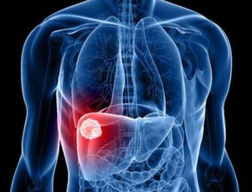 进行|在家休养的肝硬化病人应注意什么