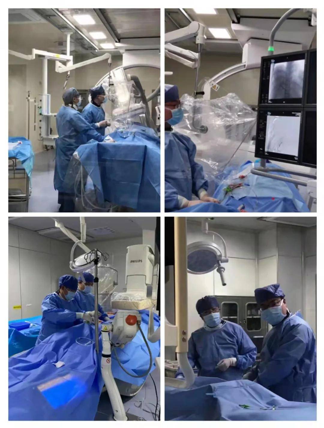 栓塞|西安市第三医院消化内科常年开展高难度介入TIPS术解决患者大难题