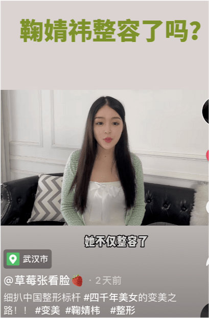 分析鞠婧祎被质疑整容！医美博主称其是硅胶隆鼻填充脂肪最成功案例