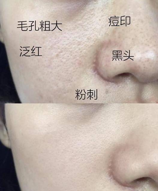 真嫩45岁佘诗曼不是装嫩是真嫩，高清怼脸近照皮肤细腻，护肤秘诀是它