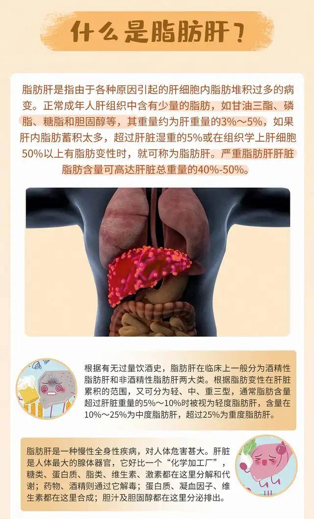 得了脂肪肝要怎么办?需要治疗吗?_治疗