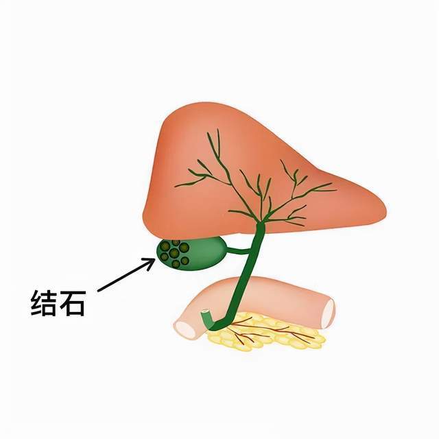 人体|「未来医生」不吃早餐危害竟然这么多？医生：早餐这样吃才最健康