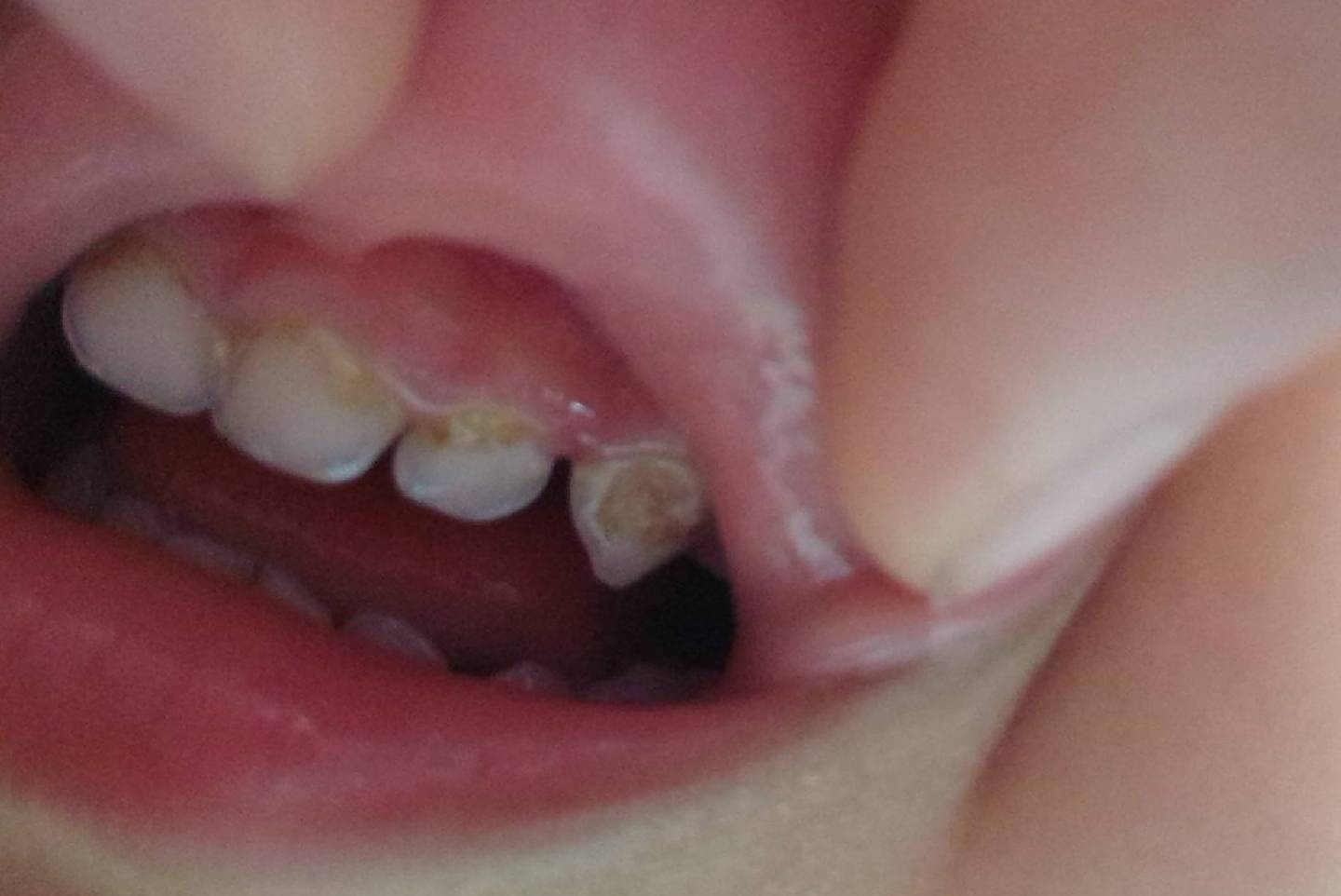 人体|这些“黑名单”零食,别再给娃买了,给娃选零食遵循“3低1少”