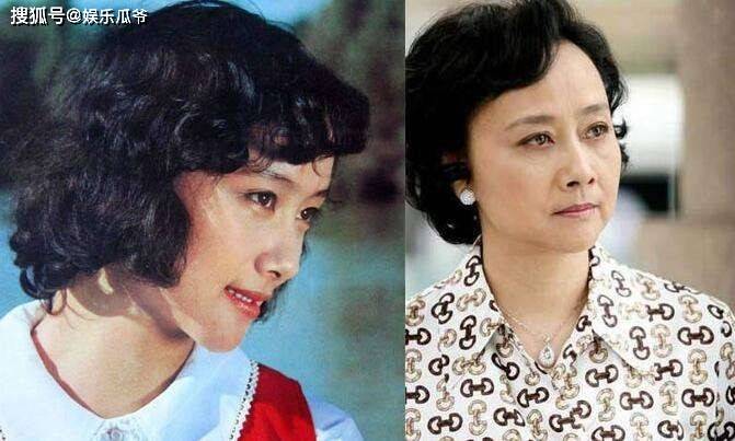 后遗症这些同龄女星都曾是绝世美人，有人整容后遗症像妖怪，有人美到老