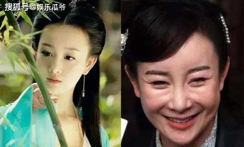 后遗症这些同龄女星都曾是绝世美人，有人整容后遗症像妖怪，有人美到老