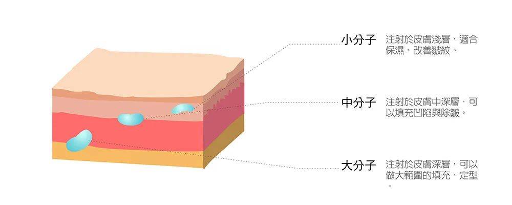 同伴不是自己不优秀，都是同伴太耀眼，聊聊水光针家族的“沧海遗珠”——嗨体2.5