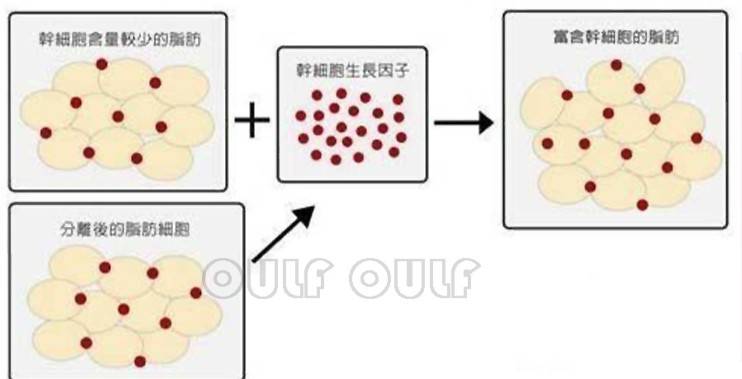 能量丑：脂肪填充2个月好难看？全脸脂肪填充后遗症让我好后悔~