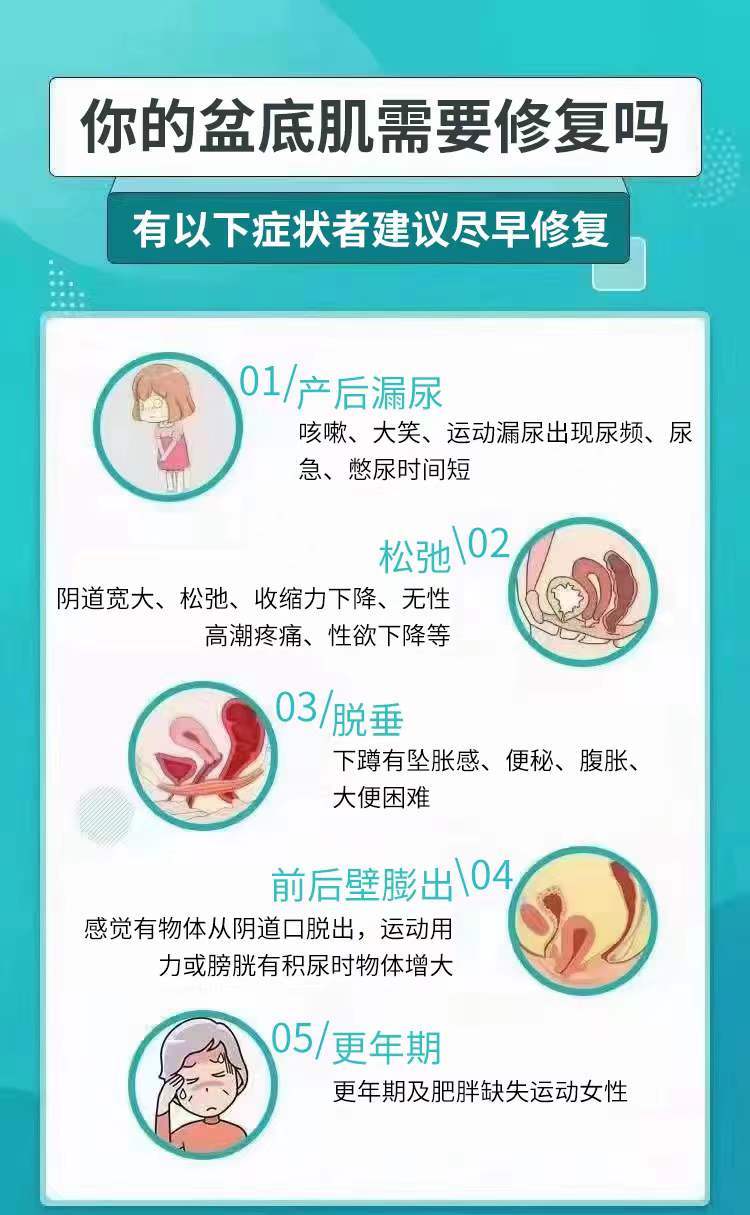 你的盆底肌需要修复吗？