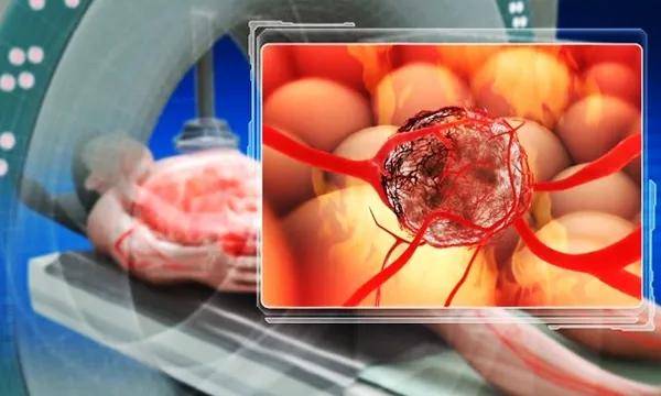 湖南省康复医院肿瘤热疗燃起生命新希望