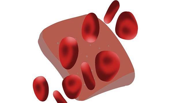 水平|胆固醇高的人，3种早餐还是别吃了，可能是血栓的加速器，要少碰