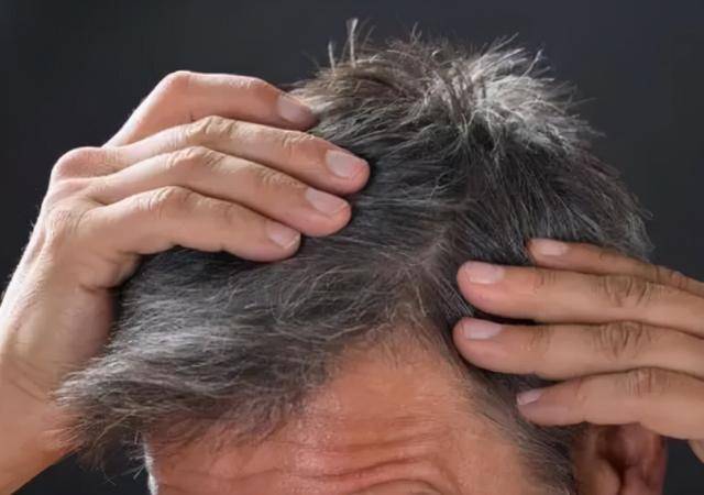 为什么会长白头发了 34650b2a376649aa9adad4c9d1ad37f3.jpeg