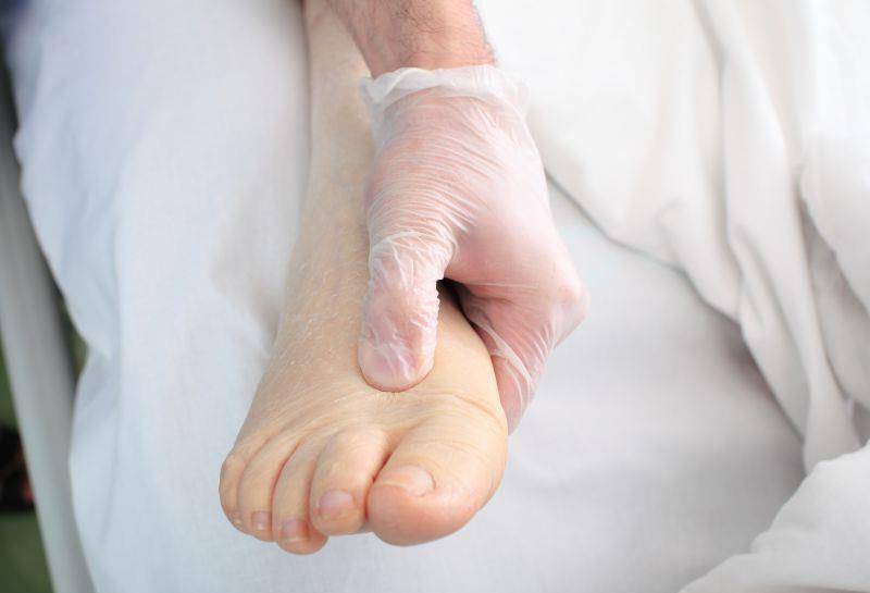 肾脏|得了肾病,为什么身体会水肿得厉害?原因逐个分析