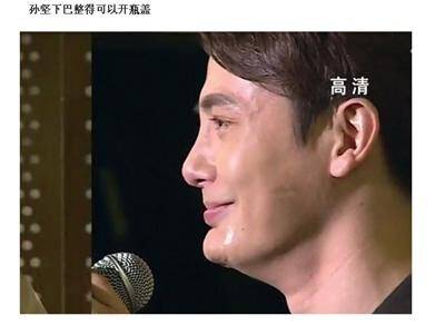 下巴明星的N种“假下巴”，尖到戳死人，翘成老巫婆，一个比一个怪异