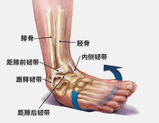 打羽毛球脚踝扭伤怎么办我们应如何预防踝关节扭伤