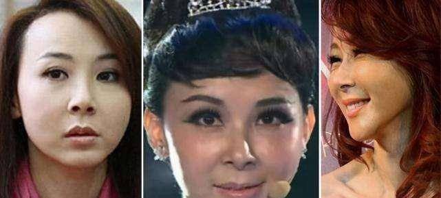 名字这些同龄女星都曾是绝世美人,有人整容后遗症像妖怪,有人美到老