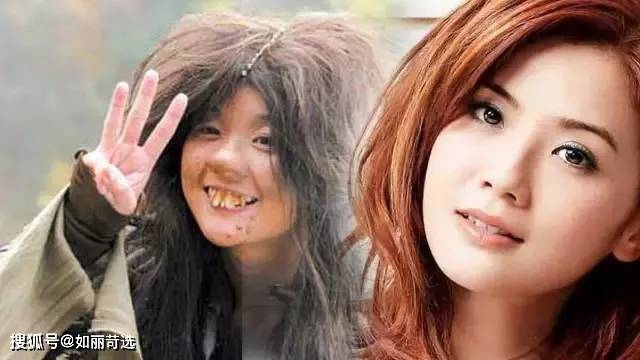 宋轶凸嘴无法修复的四种迹象，千万别中招