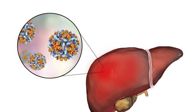 肝脏|肝好不好，看2个地方，谨记3个字，常做4事，肝会慢慢变健康