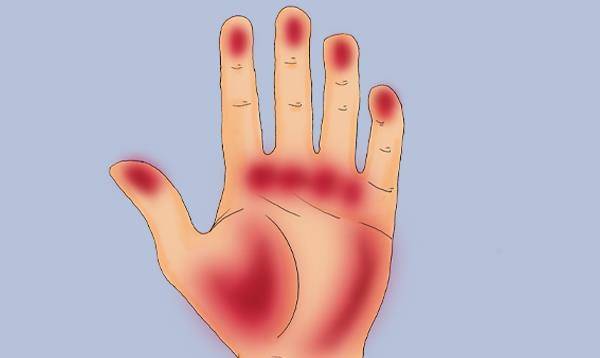 废物|肝好不好，看手就知道？手上有3个异常的人，建议你查一查肝