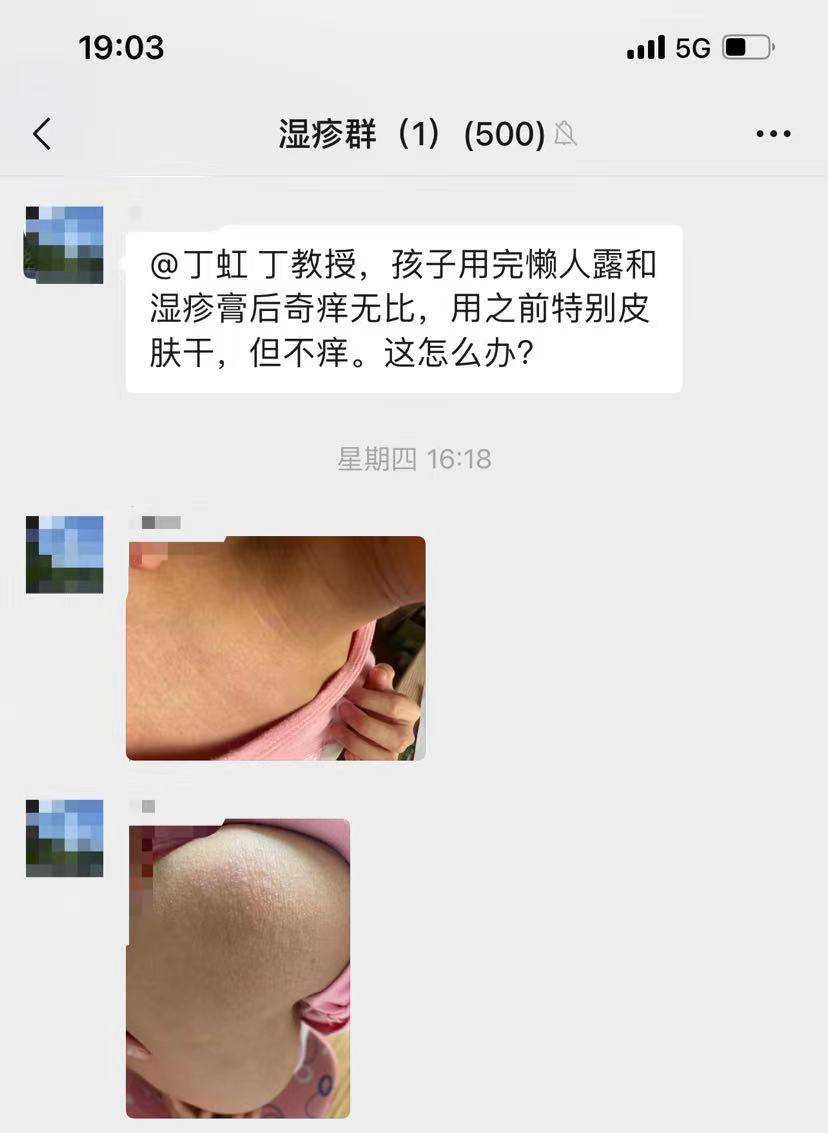 涂完 孩子用完懒人露和湿疹膏后奇痒无比，用之前特别皮肤干