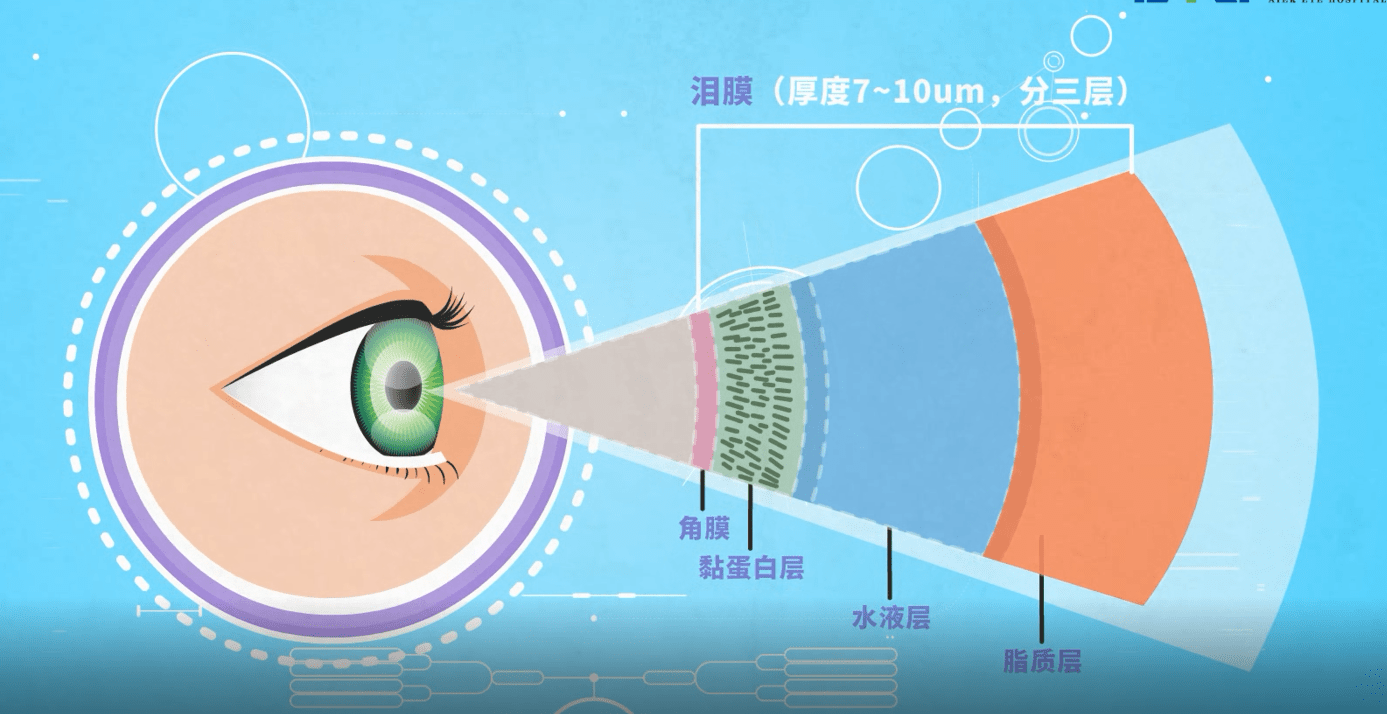 6大诱因家长要引起重视_角膜_泪液_泪膜