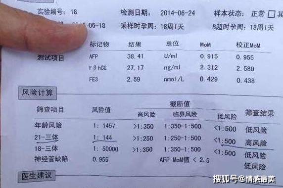 孕期产检:唐筛不折磨人,唐筛高危才折磨人!_结果_搜索_答案