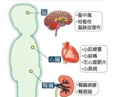 并发症|高血压并不可可怕！可怕的是高血压并发症：高血压并发症一一道来