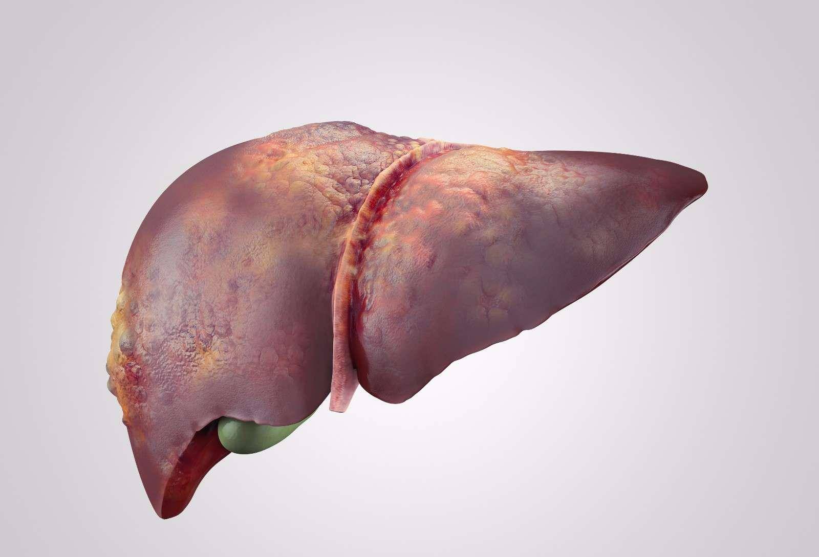 症状|感染乙肝,身体会出现这几个异常“信号”,要注意,早发现早就医