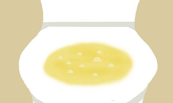 血液|肝脏不是突然就病了,身体“3黄1痛1黑”,暗示肝硬化要来了