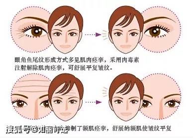 治疗号称瘦脸神器，TA不止可以瘦脸，还能用来做这些......
