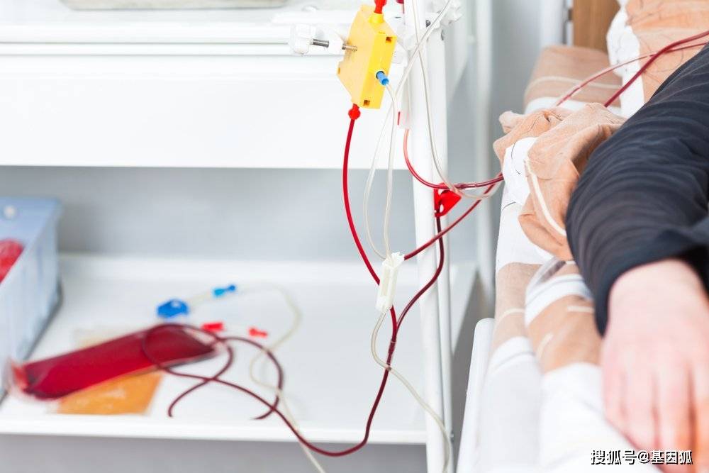 综合征|经验分享:血浆置换标准操作规程(2021版)