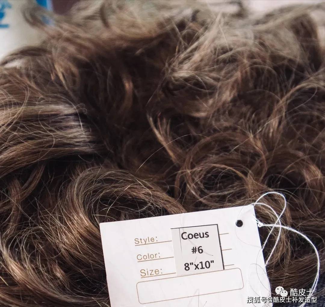 斯蒂芬·扬扎克20岁秃顶，如今却是有上万粉丝的时尚达人！前后反差完全不输楚淇