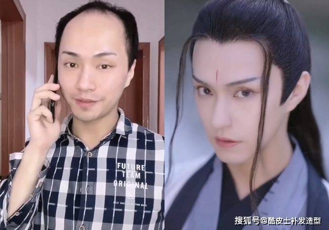 斯蒂芬·扬扎克20岁秃顶，如今却是有上万粉丝的时尚达人！前后反差完全不输楚淇