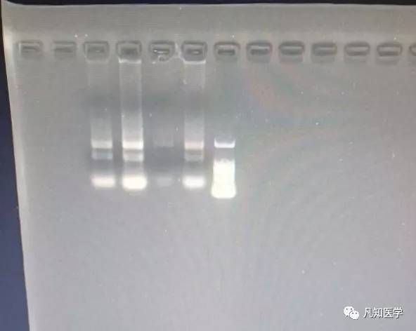 如何有效避免降解?提纯得到完整性好的动物细胞RNA_实验_样品_裂解